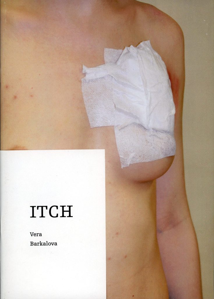 Itch